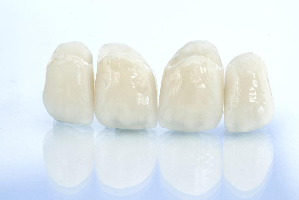 Dental-Ceramics-1-1 (1)